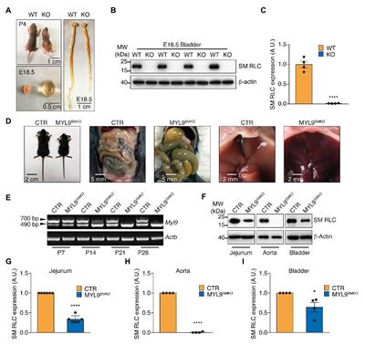 Distinct Roles of Smooth Muscle and Non-muscle Myosin Light Chain-Mediated Smooth Muscle Contraction